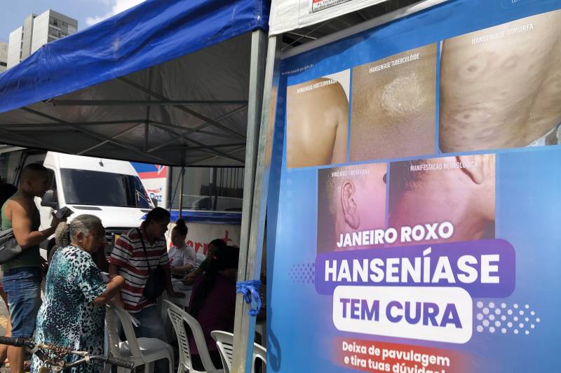 Estado realiza o Dia D de combate à hanseníase